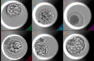 time-lapse Embryoscope